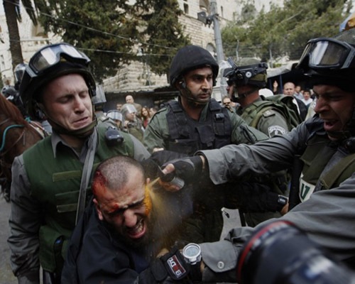 pepperspray 20 Epic Photos Which Tell Powerful Stories
